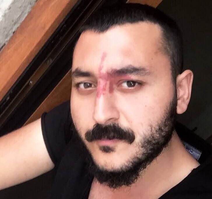 Özgür Murat GÜNKUR